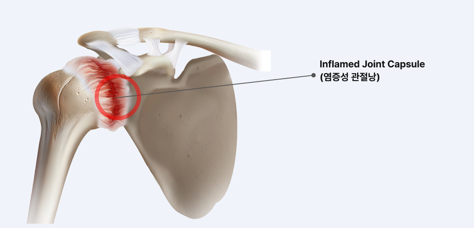 디스크 단면 일러스트