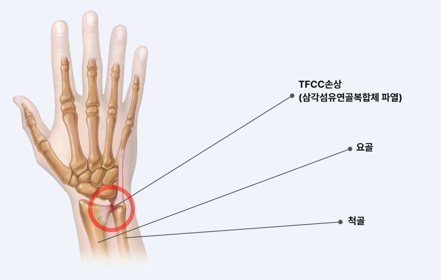 디스크 단면 일러스트